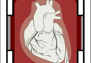 OPEN HEART SURGERY free online game on Miniplay.com